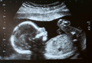 ultrasound.jpeg